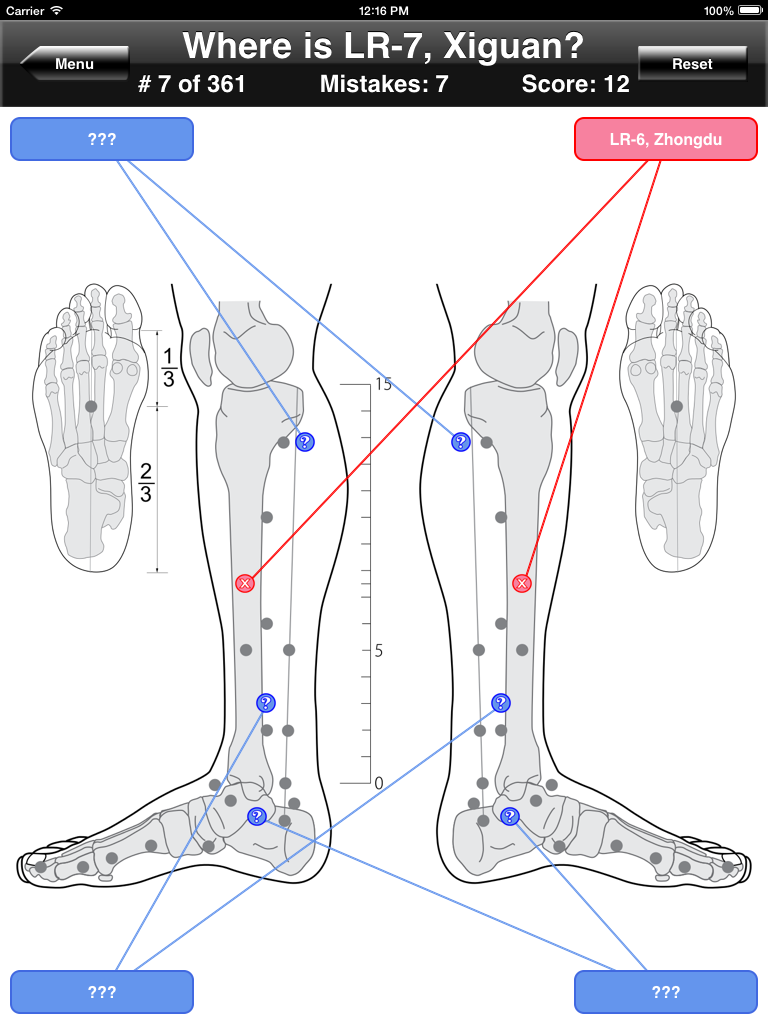 Acupuncture Points Body Quiz