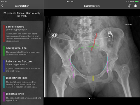 RealWorld Orthopaedicsのおすすめ画像3