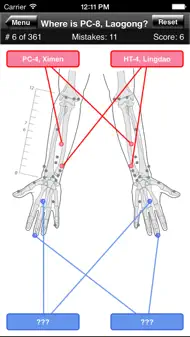 Acupuncture Points Body Quiz iphone bilder 2