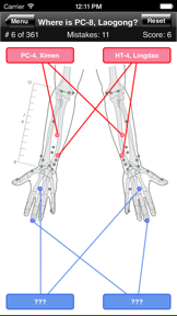Acupuncture Points Body Quiz screenshot
