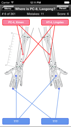 Acupuncture Points Body Quiz screenshot 3