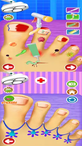 Game screenshot Сумасшедший маленький монстр ног ногти Виртуальный хирургии доктор - бесплатные больницы дети весело игра mod apk