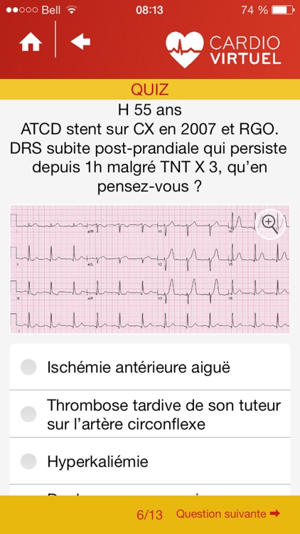 Cardio Virtuel présenté par des médecins spécialistes de l'Université Laval