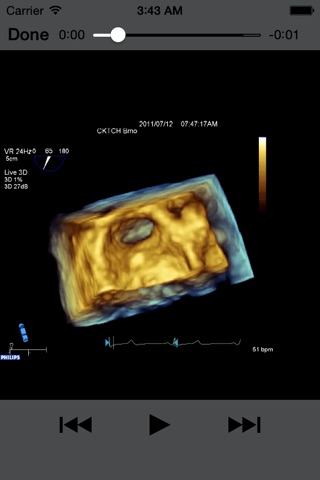 CARDIO3® 3D Echocardiography screenshot 4