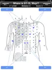 Acupuncture Points Body Quiz ipad bilder 1
