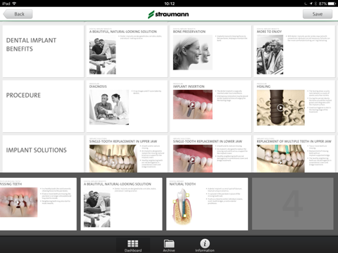 Straumann® Patient Education Appのおすすめ画像5