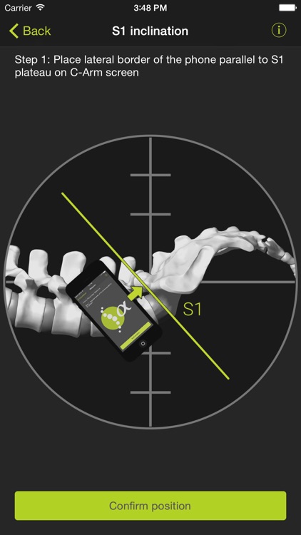 SagittalMeter Pro screenshot-4