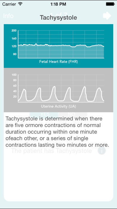 Screenshot #2 pour EFM