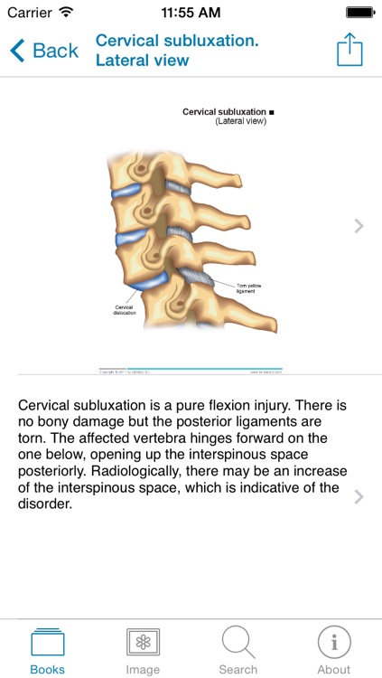 Miniatlas Musculoskeletal System screenshot-4