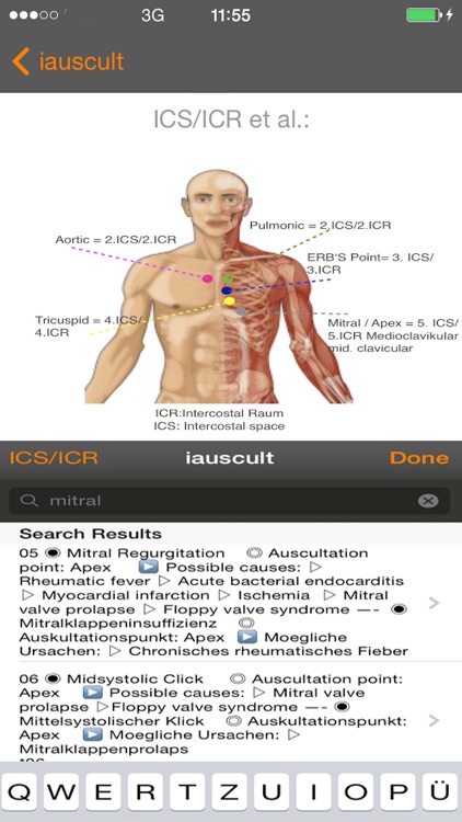 iauscult screenshot-4