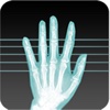 X-Ray Scanner -free