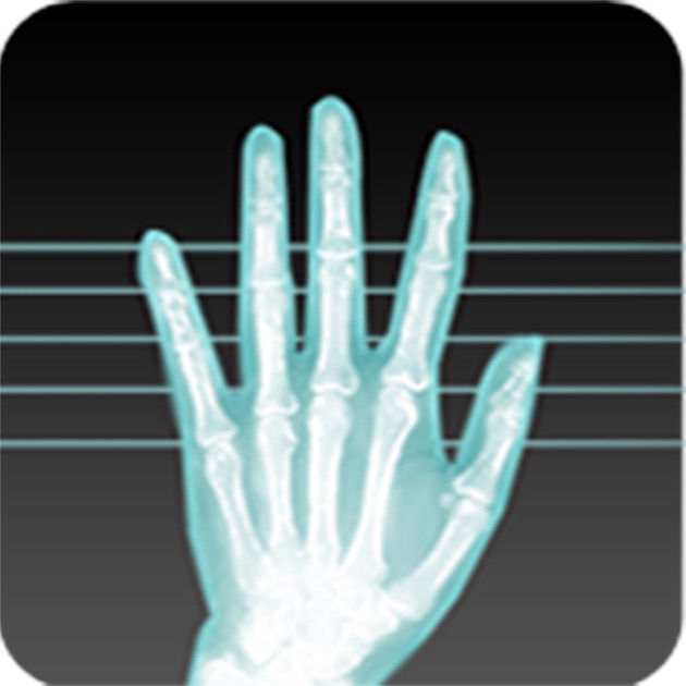 x ray blackberry download free