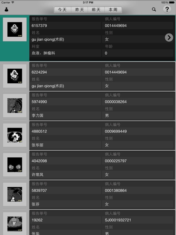 Xavier, 安博医学3D成像