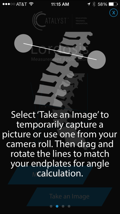 SAGI(SM) Clinical Solutions Lordosis Measurement Applicationのおすすめ画像2