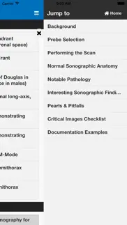 sonosupport: a clinical emergency medicine and critical care ultrasound reference tool iphone screenshot 4