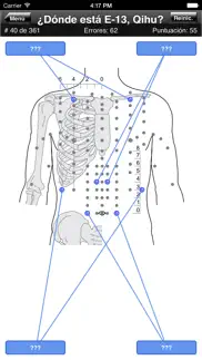 puntos de acupuntura del cuerpo iphone capturas de pantalla 2