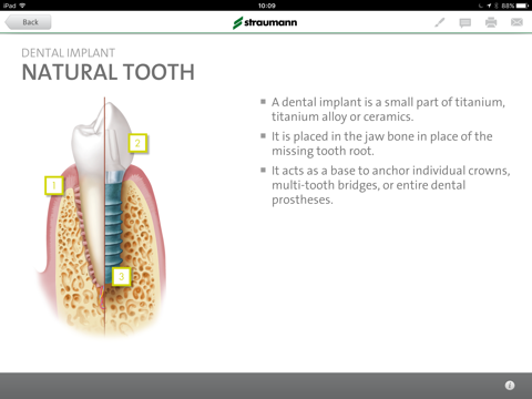 Straumann® Patient Education Appのおすすめ画像3