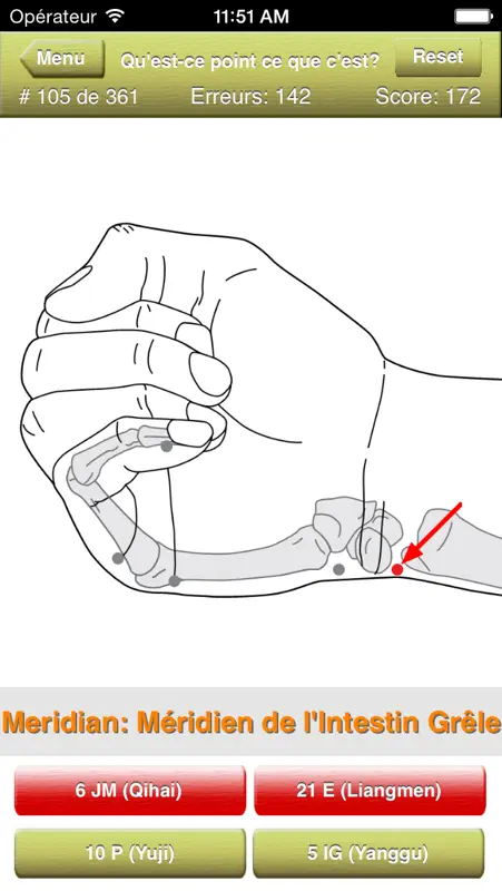 Acupuncture Points Quiz screenshot 3 of 5