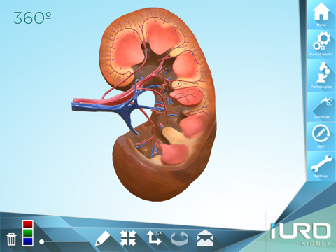iURO Kidney Lite iPad screenshot 5 - Medical app