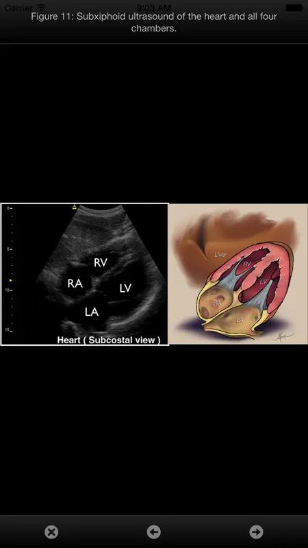 SonoSupport: a clinical emergency medicine and critical care ultrasound reference tool screenshot 5 of 5