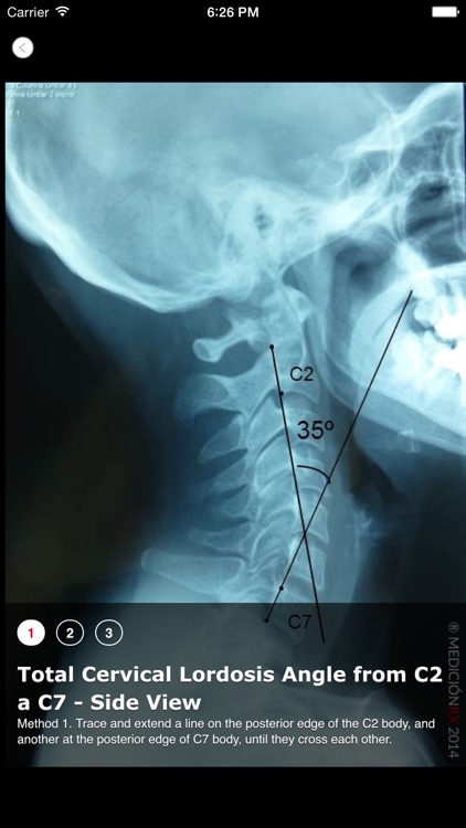 X-ray Measuring screenshot-3