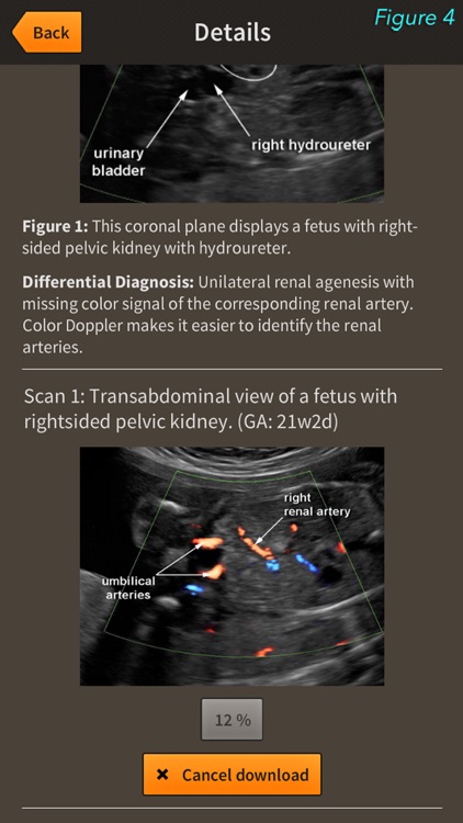 You-Scan screenshot-3