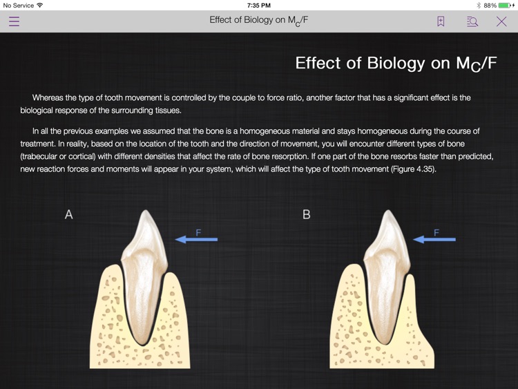 Mechanotherapy in Orthodontics Vol.1