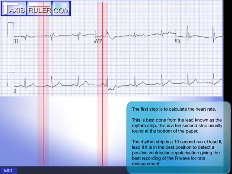 ECG Genius screenshot-3