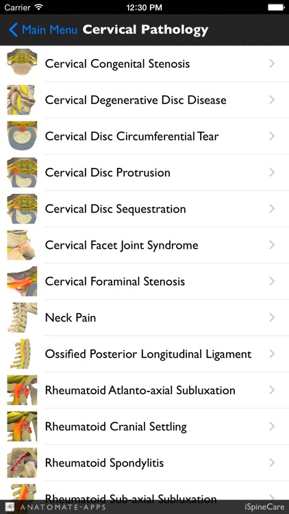 iSpineCare