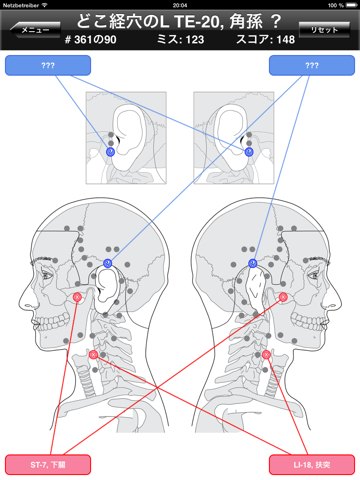 経穴ボディクイズのおすすめ画像3