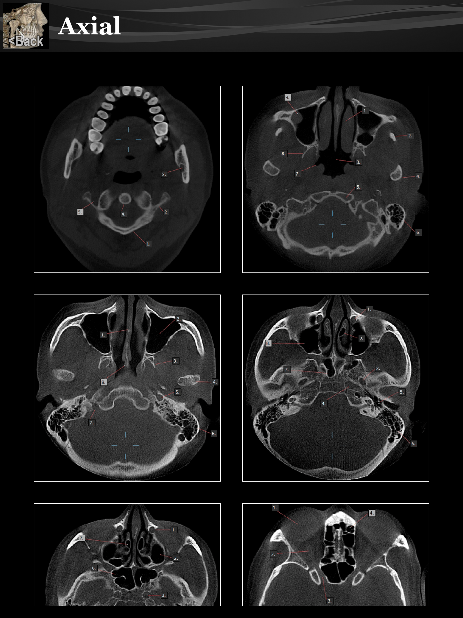 Scanatomy screenshot 5