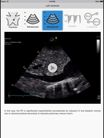 TnECHO iPad screenshot
