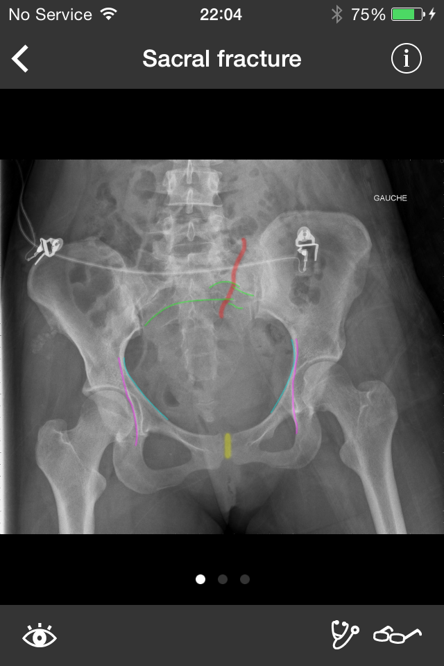 RealWorld Orthopaedics