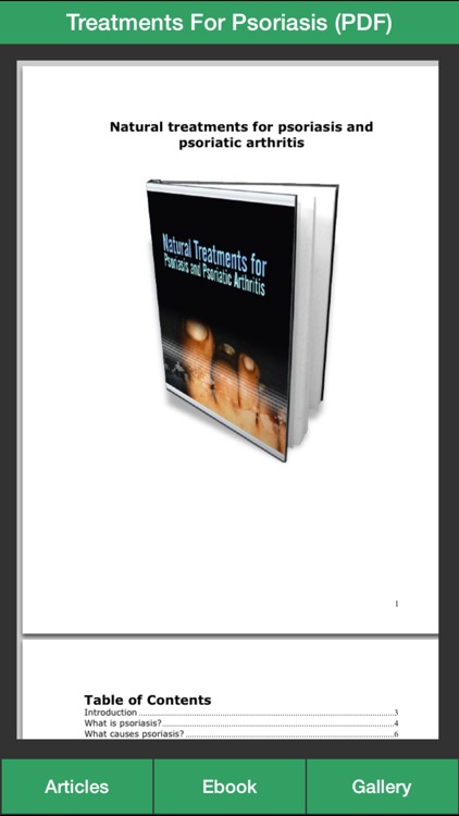 Psoriasis Guide - Learn How to Treat Your Psoriasis Naturally!