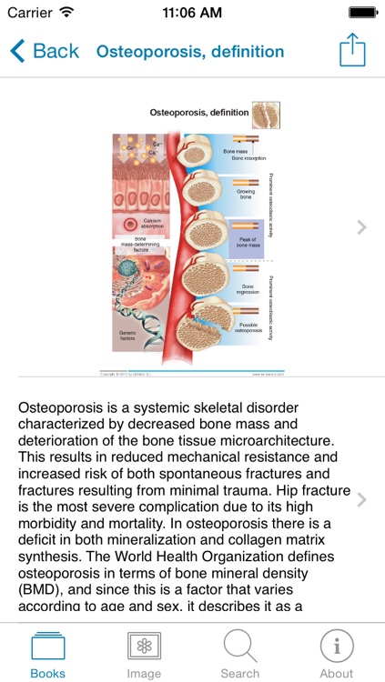 Miniatlas Osteoporosis screenshot-4