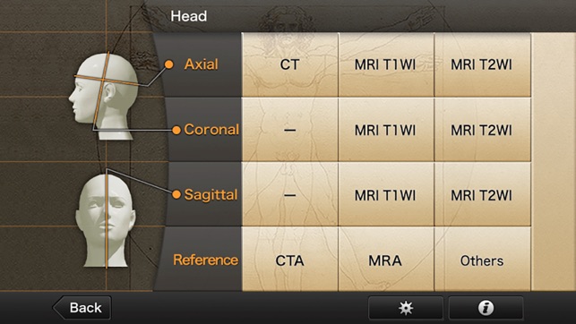 Interactive CT and MRI Anatomy(圖2)-速報App