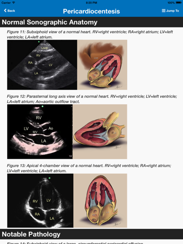 SonoSupport: a clinical emergency medicine and critical care ultrasound reference toolのおすすめ画像2