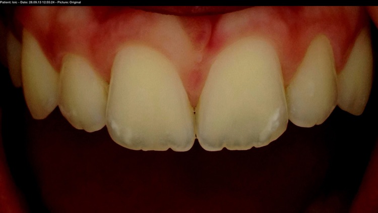 Smile Capture by Smile Line screenshot-4