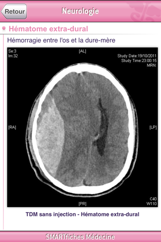 SMARTfiches Neurologie Free screenshot 2