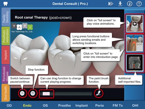 Dental Consult－English Audio Version screenshot 3