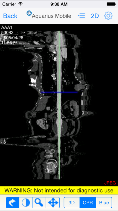 Aquarius Mobile iPhone screenshot 4 - Medical app