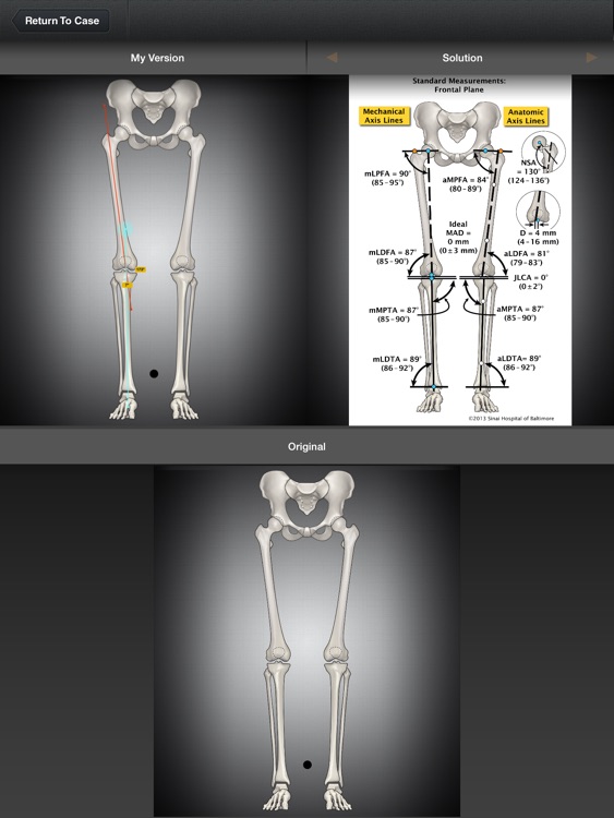 Bone Ninja screenshot-3