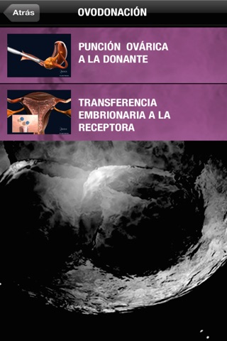 Atlas Reproducción Asistida - Merck Serono screenshot 2