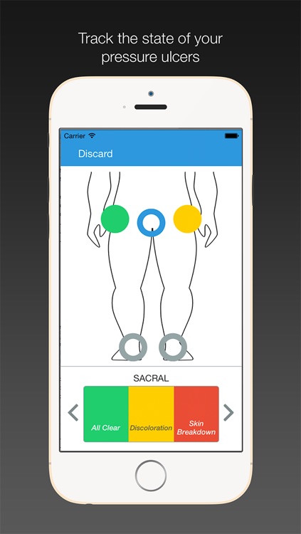 Pressure Ulcer Prevention (PUP)