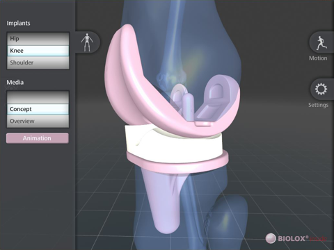 Screenshot #6 pour BIOLOX inside