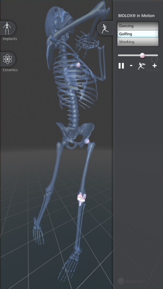 BIOLOX inside iPhone screenshot 4 - Medical app