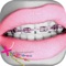 can change the intensity - the light and color of braces