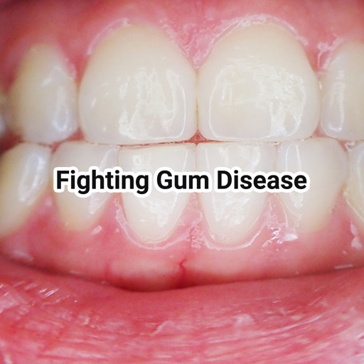 Fighting Gum Disease icon