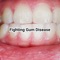 This Fighting Gum Disease App 