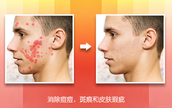 修图神器: 去水印,除瑕疵,修复照片